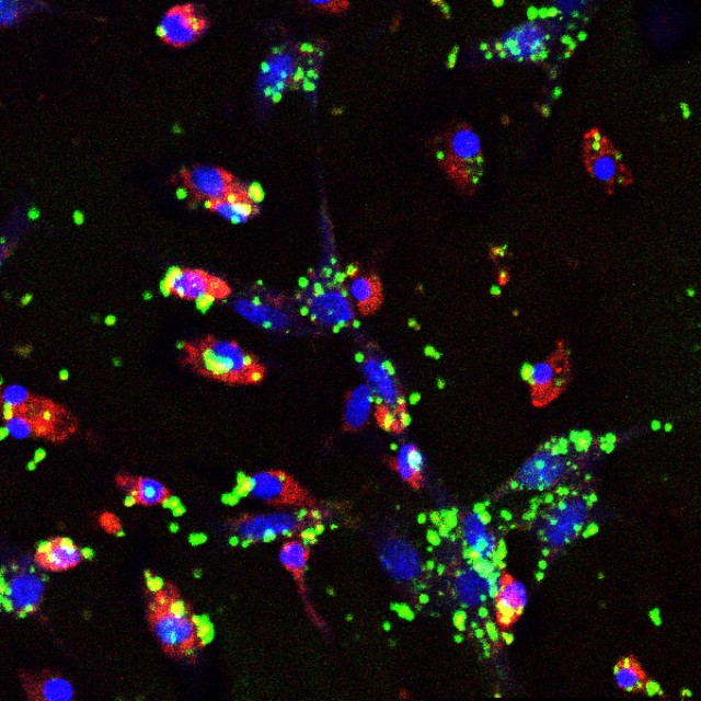 Immunofluorescence images of murine bone marrow-derived macrophages (by Shann Yu)